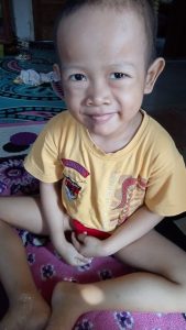 Senyum Bocah Perempuan di Kota Jambi Sembunyikan Kanker, Arda Menantikan Darmawan