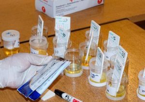 Dinas PUPR Provinsi Jambi Tes Urine Seluruh Pegawainya